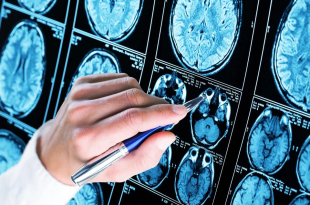 Gents bedrijf krijgt goedkeuring voor bloedtest om alzheimer op te sporen in Verenigde Staten