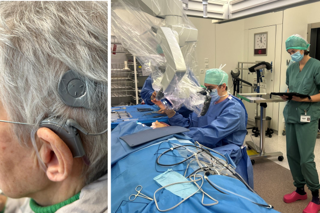 AZ Herentals plaatst voortaan hoorimplantaten