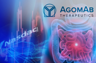 Antwerpse biotechbedrijf Agomab in het rood bij beursdebuut op Nasdaq